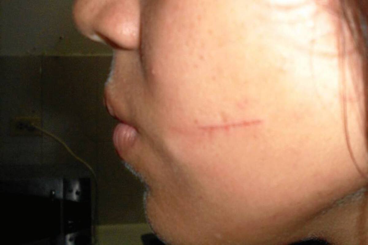 Denuncian agresión escolar a estudiante de décimo grado (Foto: Suministrada /VANGUARDIA LIBERAL)