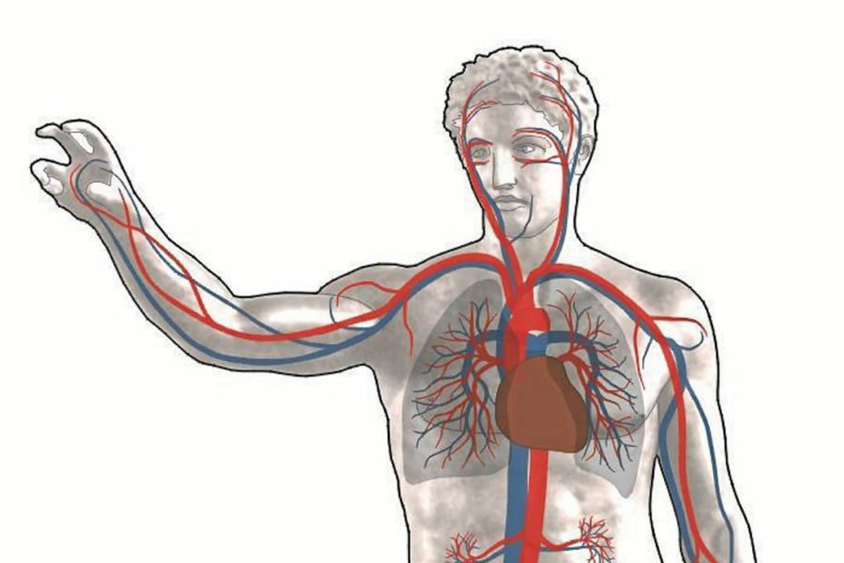 La causa más común de las alteraciones circulatorias arteriales es la arteriosclerosis, que consiste en un proceso degenerativo que no tiene cura y que provoca la obstrucción en las arterias con el consiguiente cese de aporte sanguíneo en ciertas partes del cuerpo, originando graves consecuencias como infarto de miocardio, infartos cerebrales y gangrena en los dedos. (Foto: Tomada de Internet / VANGUARDIA LIBERAL)