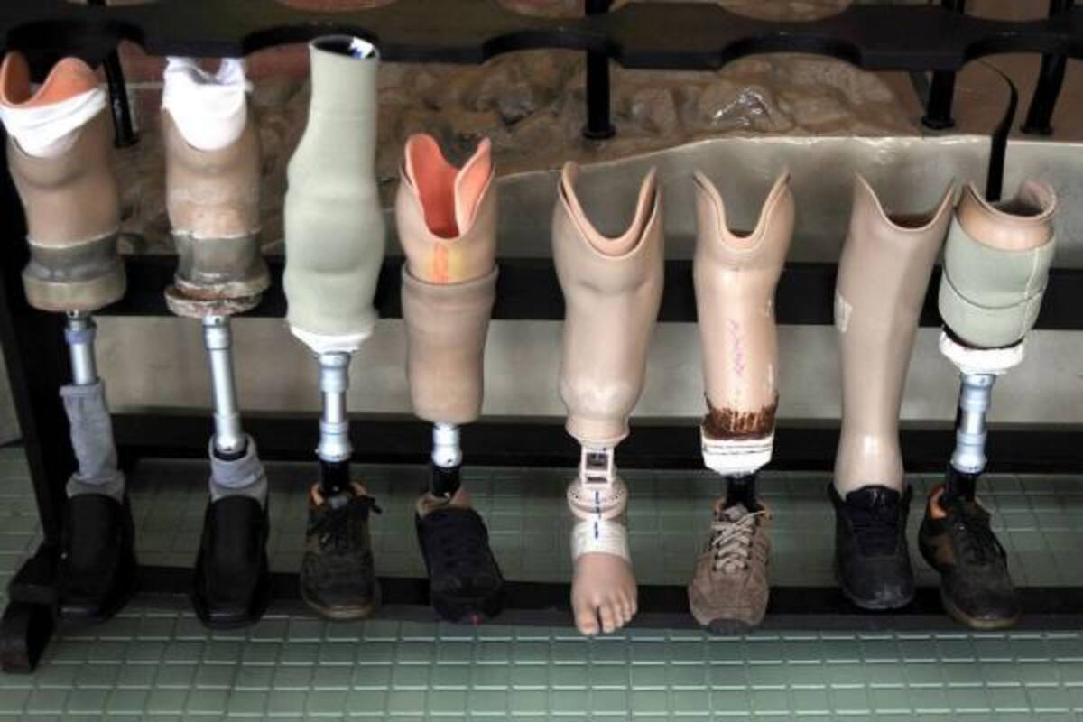 La gran mayoría de los discapacitados tienen que recurrir a la tutela para que la EPS les de elementos como medicinas, prótesis y sillas de rueda adecuadas, pues no están incluidos en el POS. (Foto: Archivo / VANGUARDIA LIBERAL)