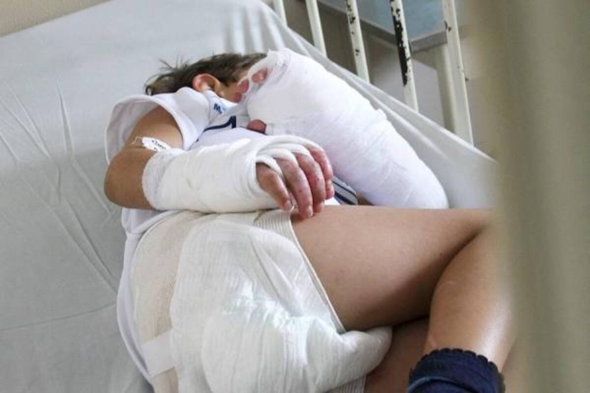 Quemaduras de segundo grado y un trauma craneoencefálico es el diagnóstico del menor que fue alcanzado por un rayo en Curití. (Foto: Archivo/VANGUARDIA LIBEAL )