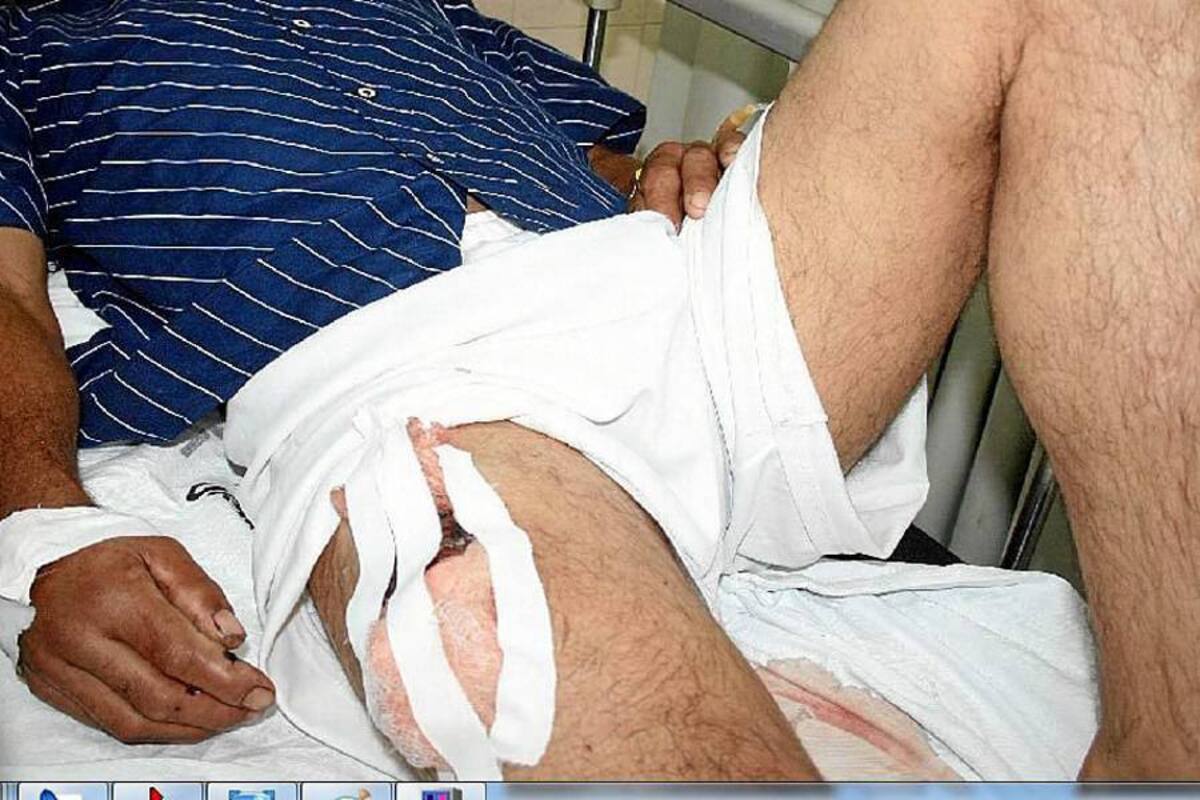 Por un accidente casero, el agricultor Víctor Julio Hernández, de 45 años de edad, tuvo que ser remitido a Barrancabermeja para una cirugía. Se disparó en la pierna. (Foto: Suministrada/VANGUARDIA LIBERAL)