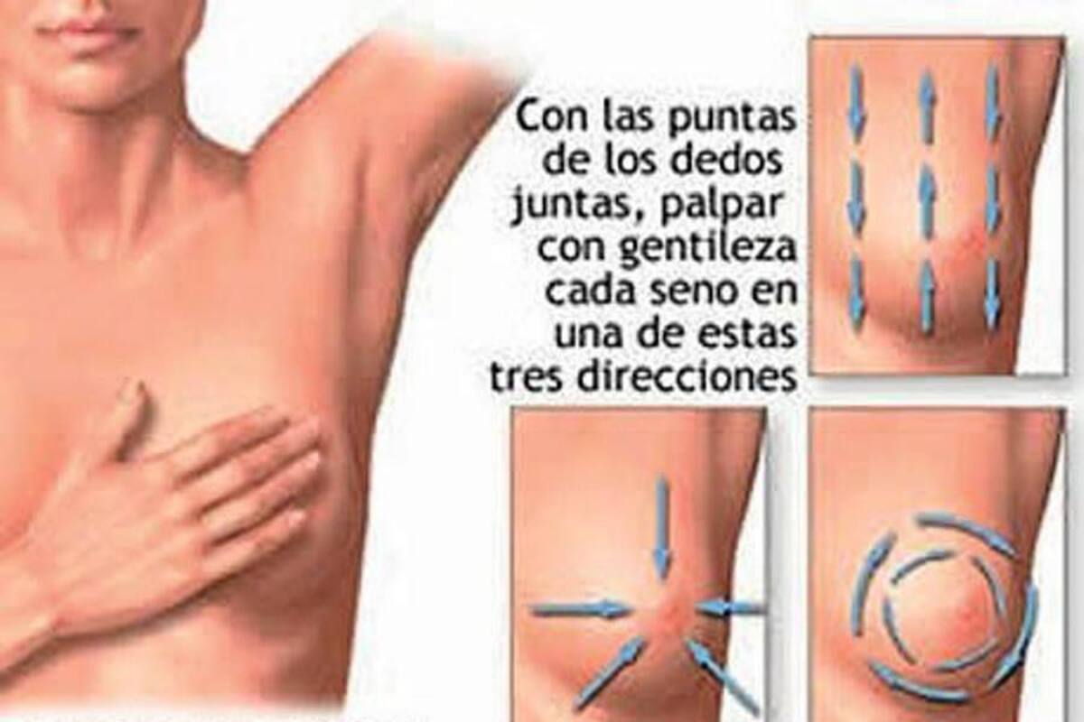 Autoexamen de seno: Inspección manual (de pie). (Foto: Tomada de Internet / VANGUARDIA LIBERAL)