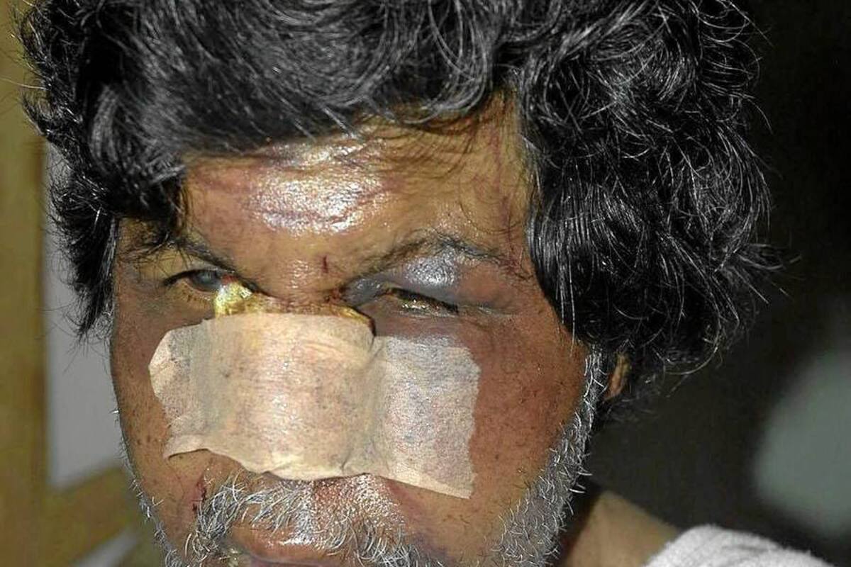 Investigan extraña golpiza a un hombre de 62 años