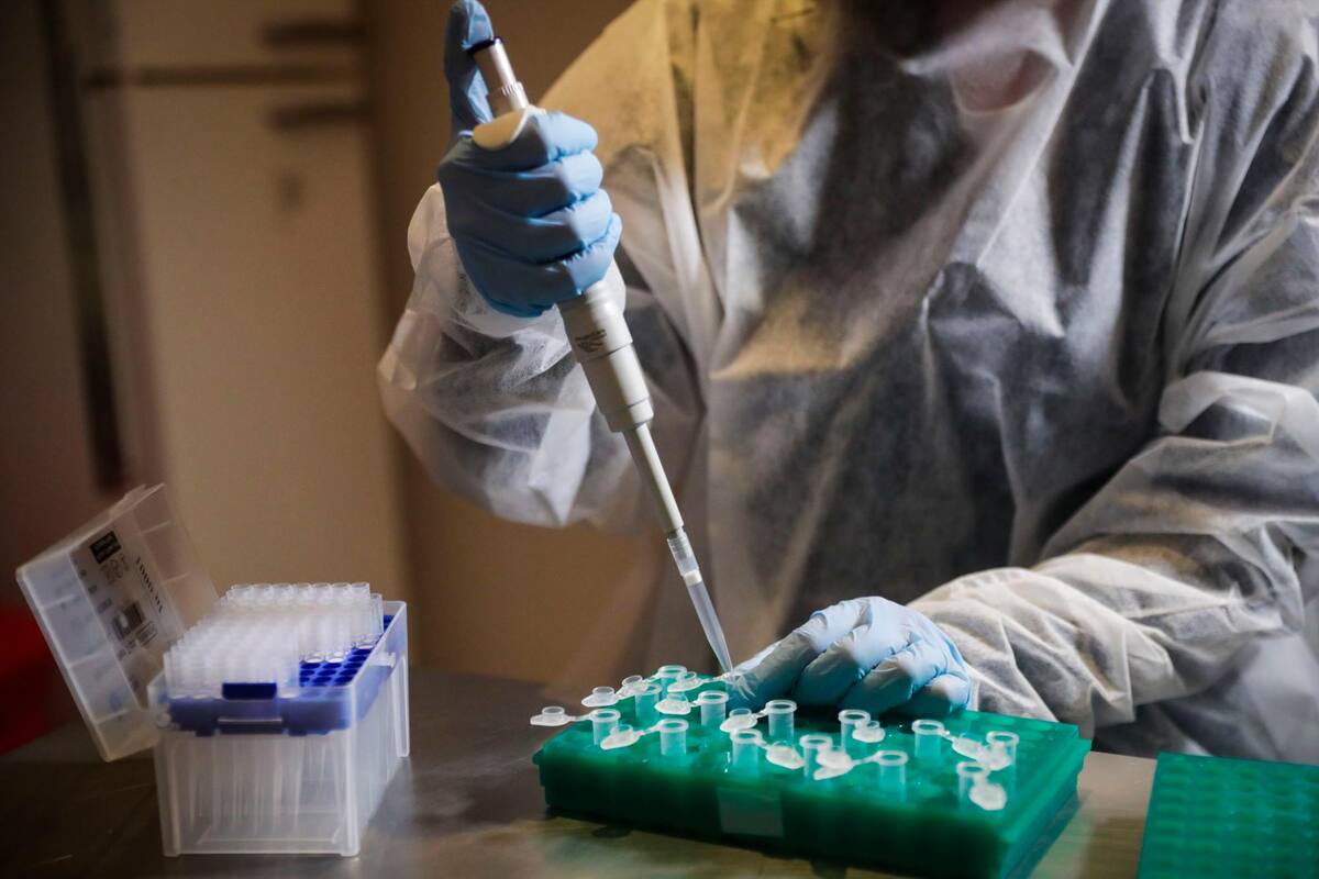 La Organización Mundial de la Salud, OMS, señala que hay entre seis a nueve candidatas a vacunas en las etapas avanzadas de investigación. (Foto: EFE / VANGUARDIA)