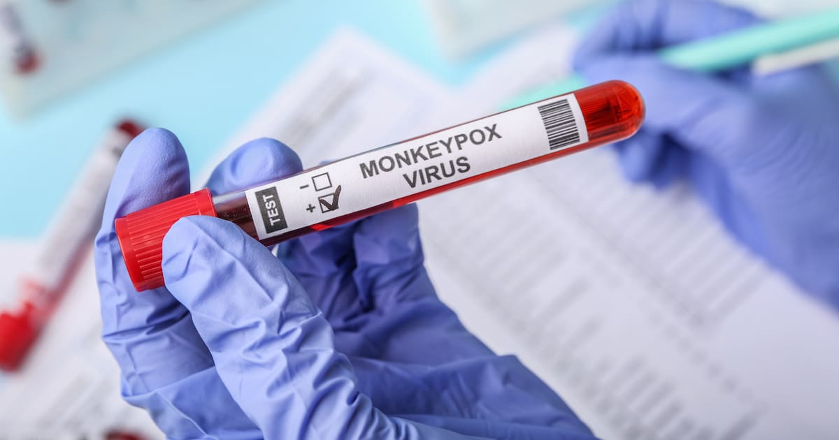 Atención: Se confirma segundo caso de mpox clado Ib en Colombia