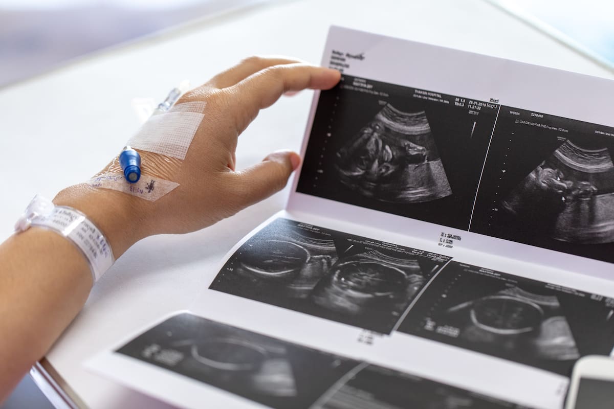 Diversas investigaciones han concluido que, por tempranos que sea, los abortos espontáneos tienen consecuencias físicas y emocionales en la mujer.