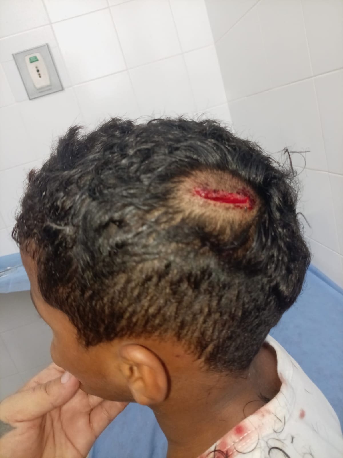 Un ventilador de techo cayó sobre tres menores de edad que recibían clases en una escuela de Yondó, Antioquia.