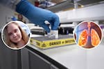 Alerta en Rusia: hospitales de Siberia, en cuarentena por sospecha de peste pulmonar