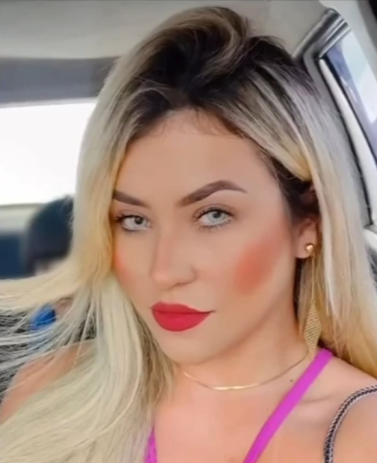 Mujer recibió un disparo durante el velorio de su madre en Minas Gerais. Amanda Arantes recibió tres disparos y tuvo que ser trasladada a otro hospital debido a la gravedad de su lesión medular.