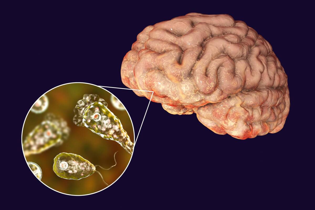 La Naegleria fowleri, conocida como ‘ameba comecerebros’, es un protozoo parásito con altos niveles de letalidad, y pueden encontrarse en aguas calientes y estancadas, como sería el caso de lagos, ríos, fluidos termales o charcos calentados por el sol. Internet / VANGUARDIA