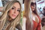 Andreia Vieira murió tras someterse a seis cirugías estéticas en Brasil: investigan su muerte