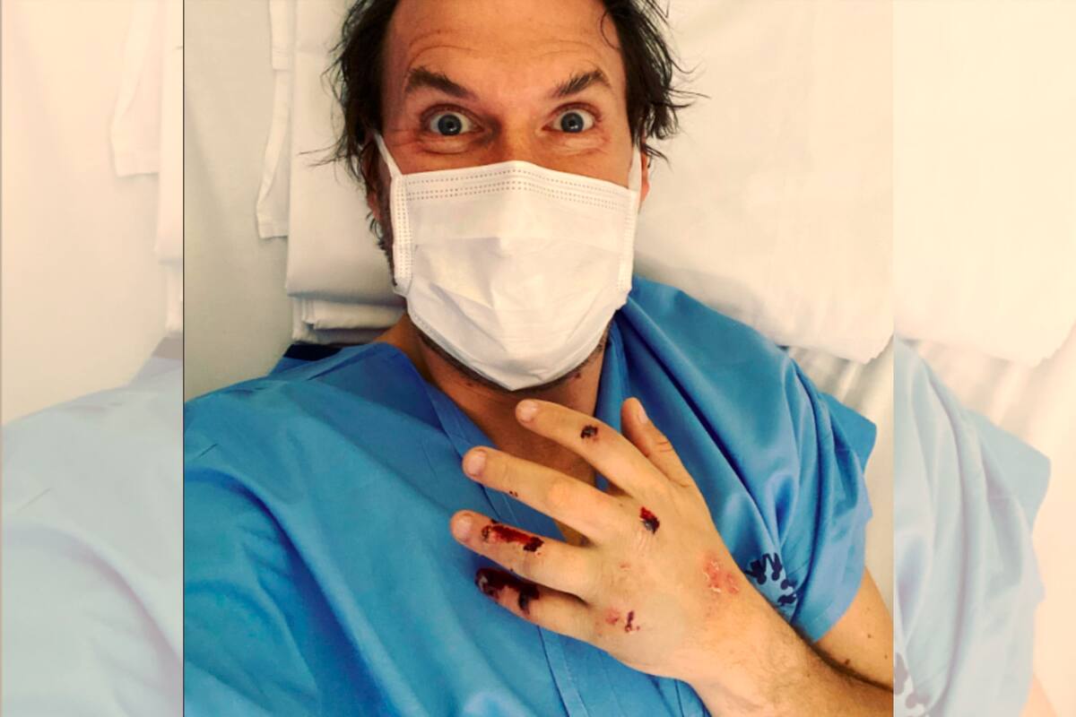 En la foto se ve a Andrés Parra con bata de clínica y tapabocas acostado en una camilla de la institución médica donde llegó a pedir auxilio por su mano. Foto tomada de Instagram/VANGUARDIA