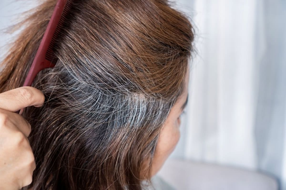 Arrancar una cana podría causar alopecia expertos alertan sobre el riesgo para el cabello. | Foto: Canva.