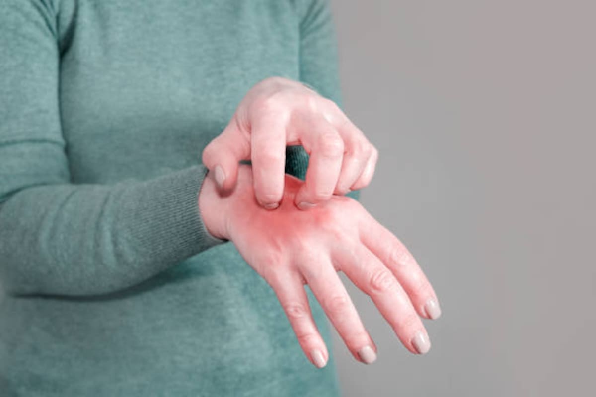 Los resultados podrían orientar futuras investigaciones sobre tratamientos para la artritis reumatoide, aunque todavía deben evaluarse en seres humanos.
