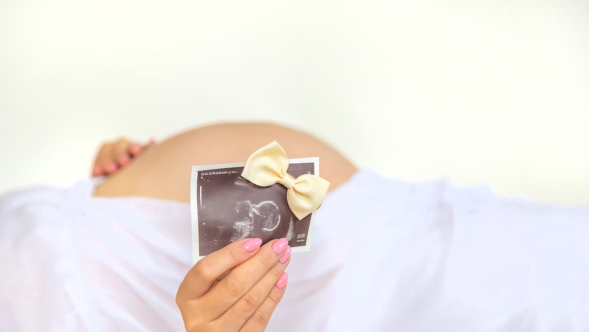 Así será la licencia remunerada por aborto en 2026 tras decisión de la Corte Constitucional // 123RF.