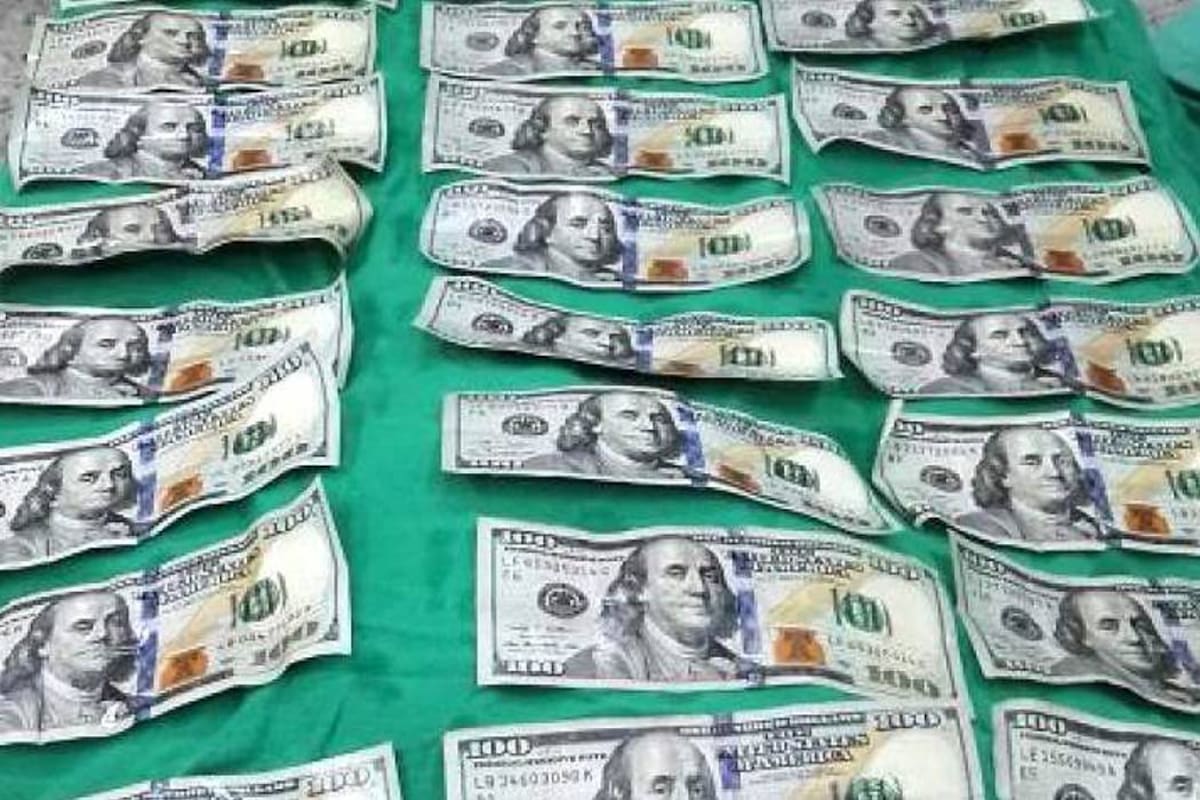 Los billetes que lograron ser extraídos por los médicos mediante una cirugía se encontraban en perfecto estado. (Foto: Suministrada/VANGUARDIA LIBERAL)