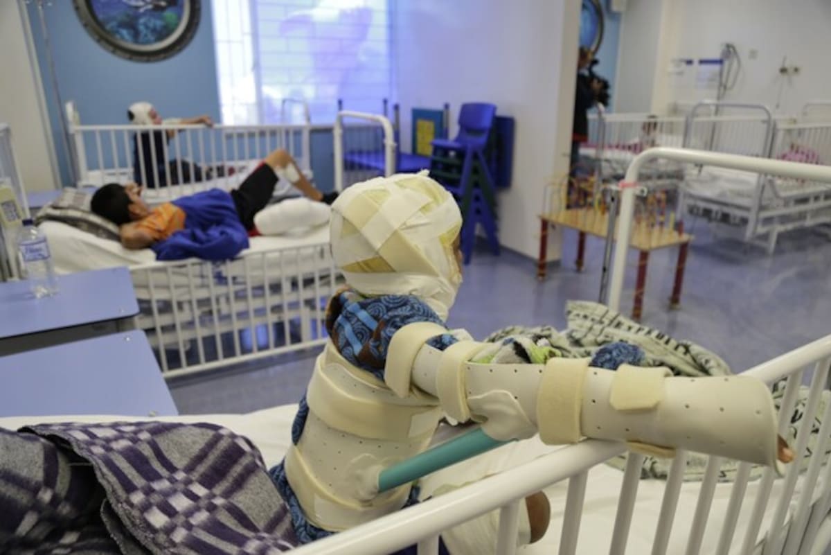 Aumenta el balance de quemados en Colombia por pólvora y más de 400 son niños. | Foto: Colprensa