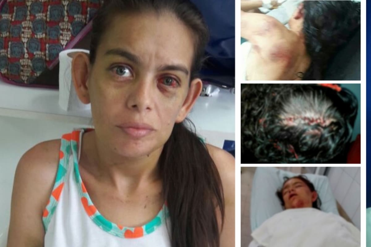 50 puntos de sutura recibió mujer agredida por su esposo en Santander (Foto: Suministrada / VANGUARDIA LIBERAL)