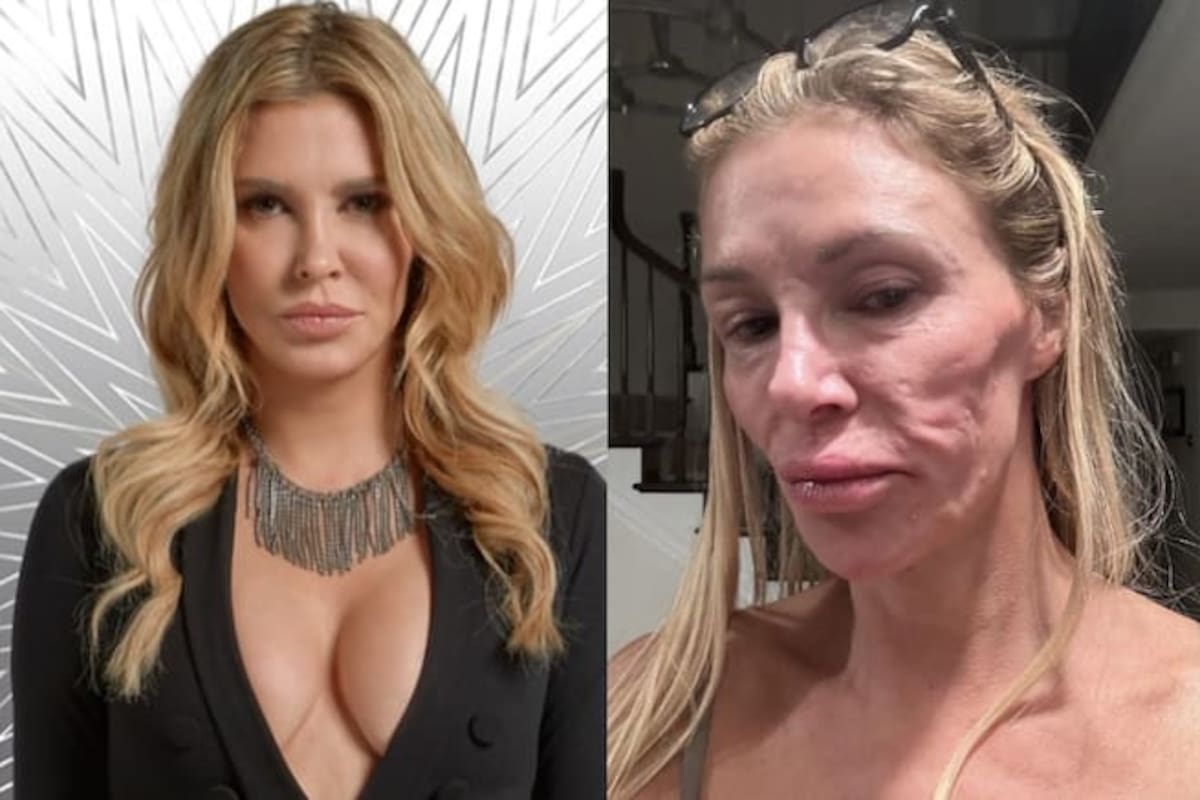 Implantes rotos y una infección: lo que vivió Brandi Glanville.