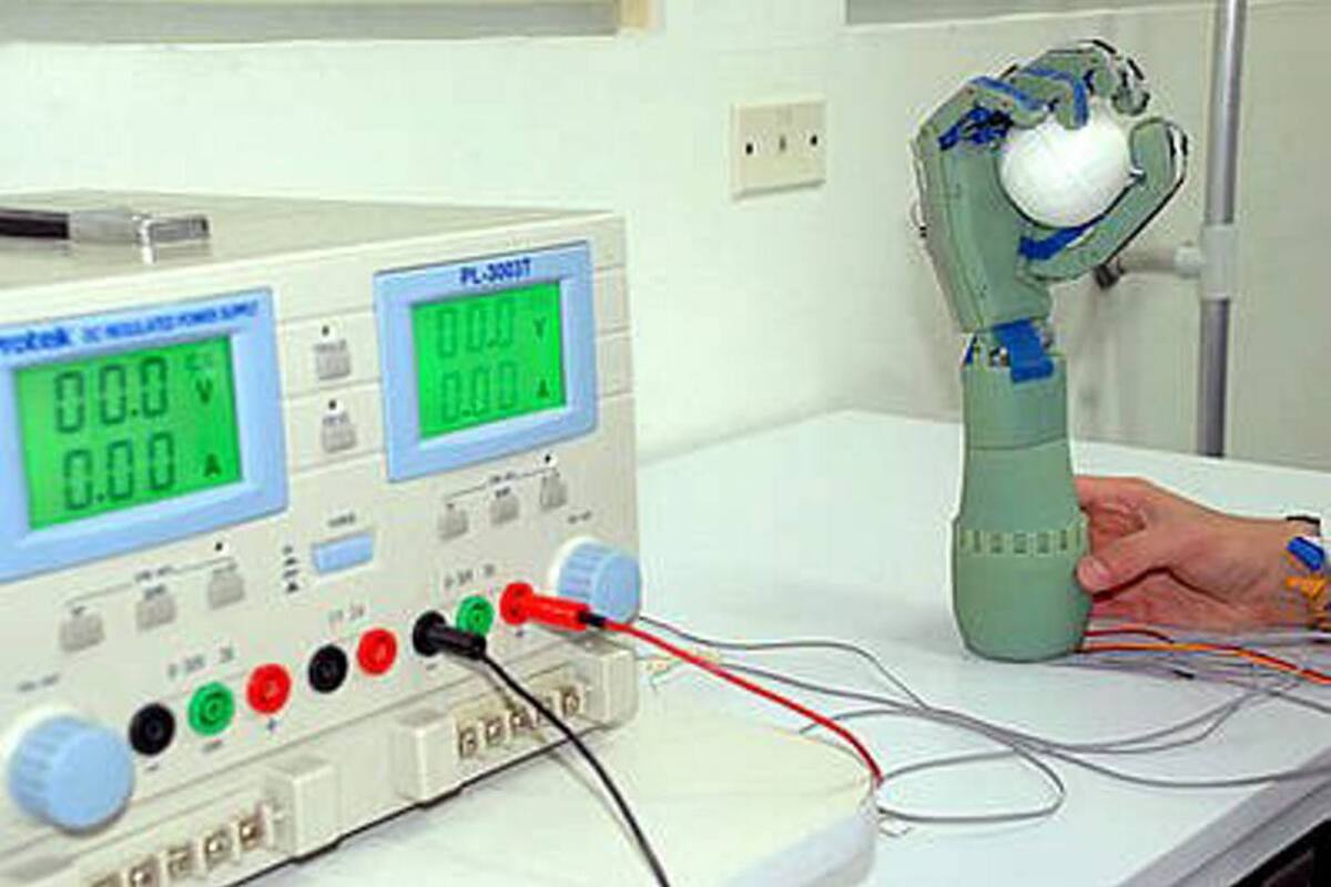 El brazo robótico permite paliar la carencia de este órgano, mediante los siete grados de libertad que posibilita. (Foto: Suministrada/ VANGUARDIA LIBERAL)