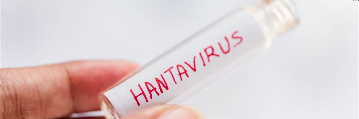 Expertos de la Universidad de Santander explican por qué no hay alarma por hantavirus en nuestro departamento.