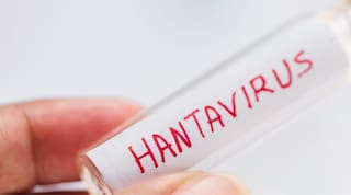 Hantavirus: ¿qué tan grande es el riesgo para Santander ?