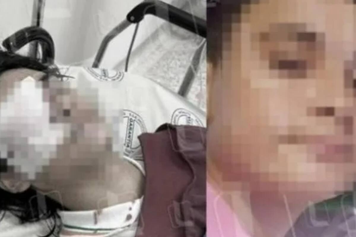 Un niño de 14 años perdió la vista de uno de sus ojos debido a un brutal ataque perpetrado por uno de sus compañeros de clase.