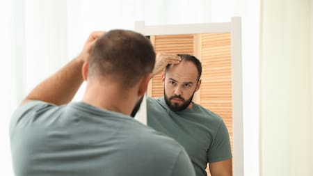 Alopecia androgenética y salud capilar las razones del aumento de consultas en Colombia