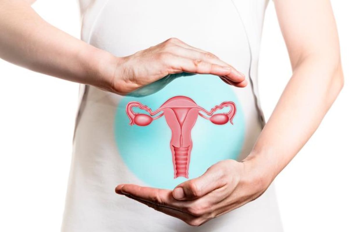 El cáncer de cuello uterino es una enfermedad grave y común en Colombia, siendo la cuarta causa de muerte por cáncer en mujeres. Getty Images / VANGUARDIA