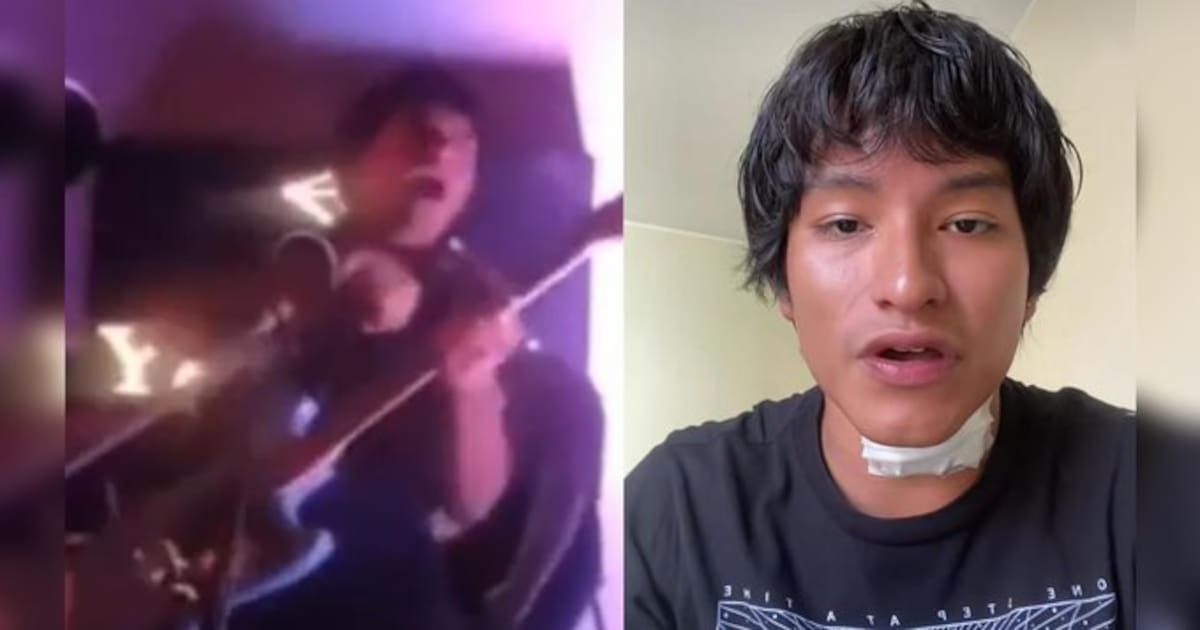 El cantante recibió la descarga eléctrica mientras conectaba su guitarra y usaba el micrófono, lo que lo dejó inmovilizado por varios segundos. Fue rescatado por su banda y el equipo técnico del local, lo que evitó consecuencias mayores durante el concierto.