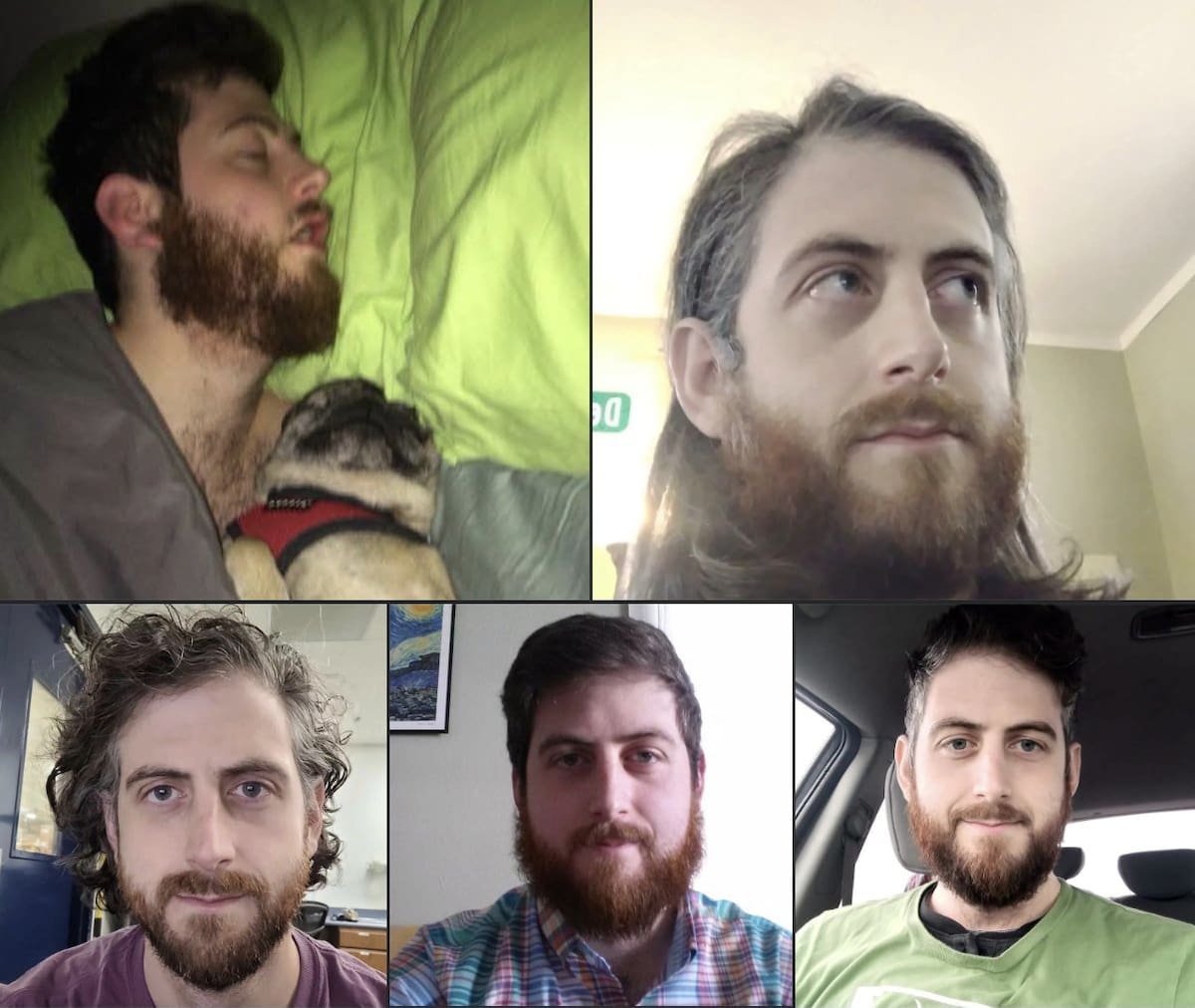 Investigadores dicen que Christopher Peden se cortó el pene, le prendió fuego y luego lo usó para incendiar el garaje de su madre. El hombre enfrenta un cargo por un delito de Incendio provocado.