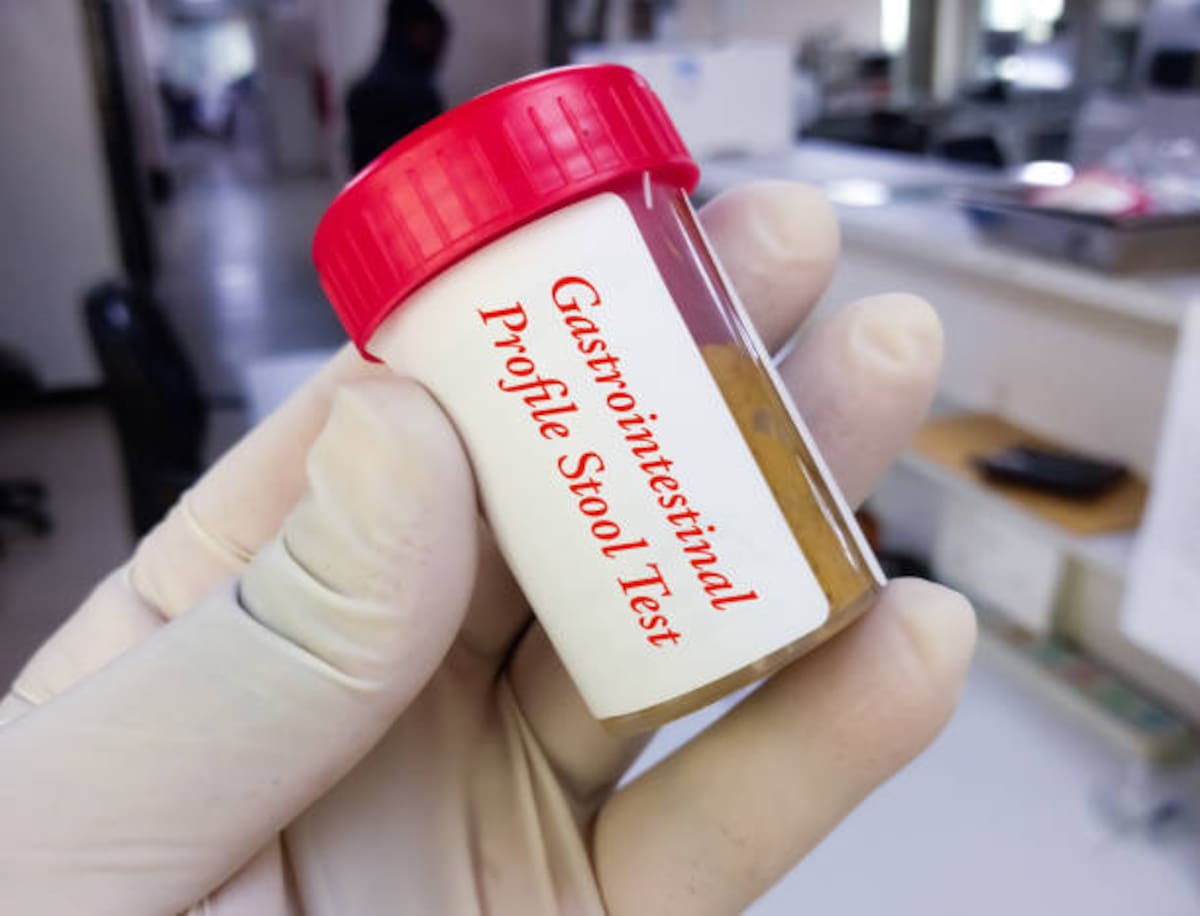 La ciclosporiasis es una infección intestinal causada por el parásito Cyclospora cayetanensis. Las personas suelen contraer la infección al consumir alimentos o agua contaminados con heces que contienen el parásito.
