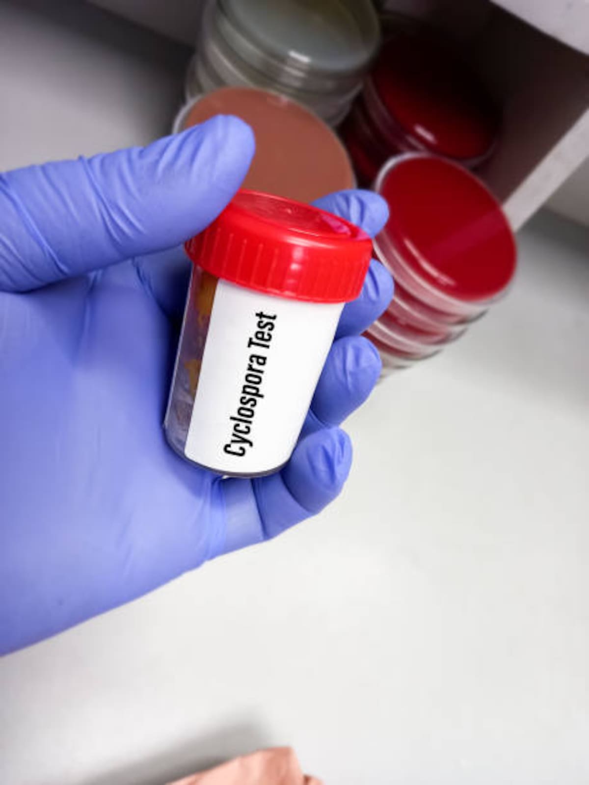 Científicos trabajan para mejorar la detección de Cyclospora en la cadena alimentaria.