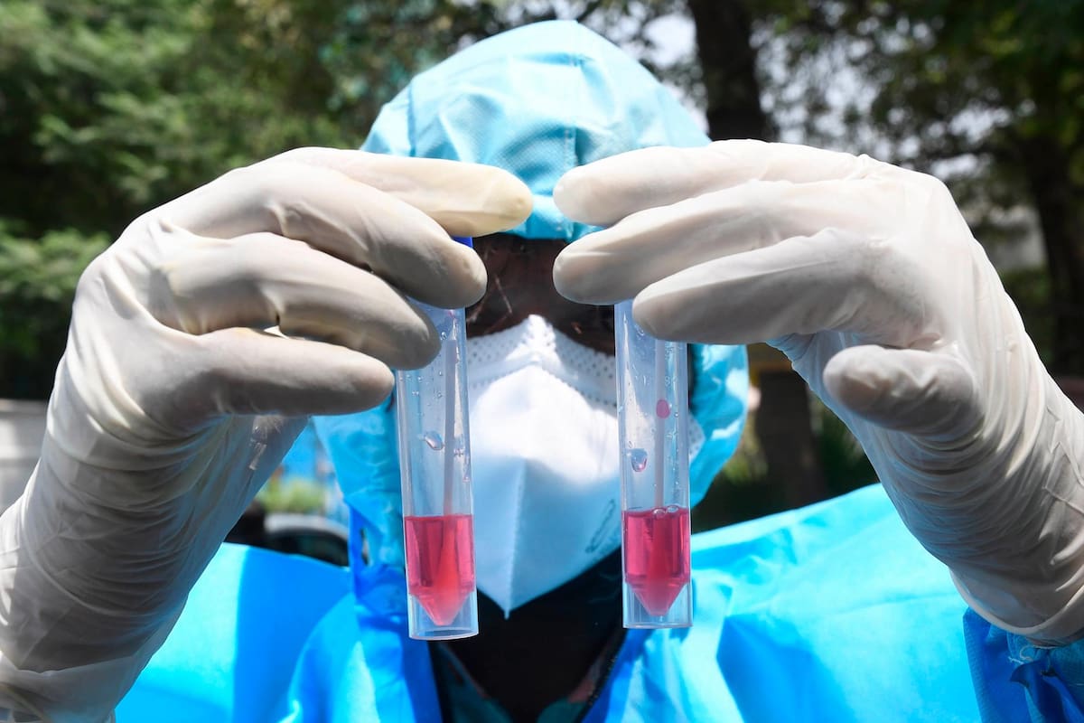 Los investigadores han estudiado 10 especies, de las que cinco (humanos, gatos, hurones, civetas y perros) tuvieron casos documentados de infección por la COVID-19. EFE / VANGUARDIA