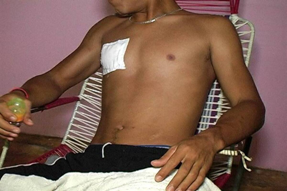 Tres puñaladas recibió el joven tras ser interceptado por dos sujetos cuando transitaba por el sector de Paso Nivel. (Foto: Suministrada/ VANGUARDIA LIBERAL)