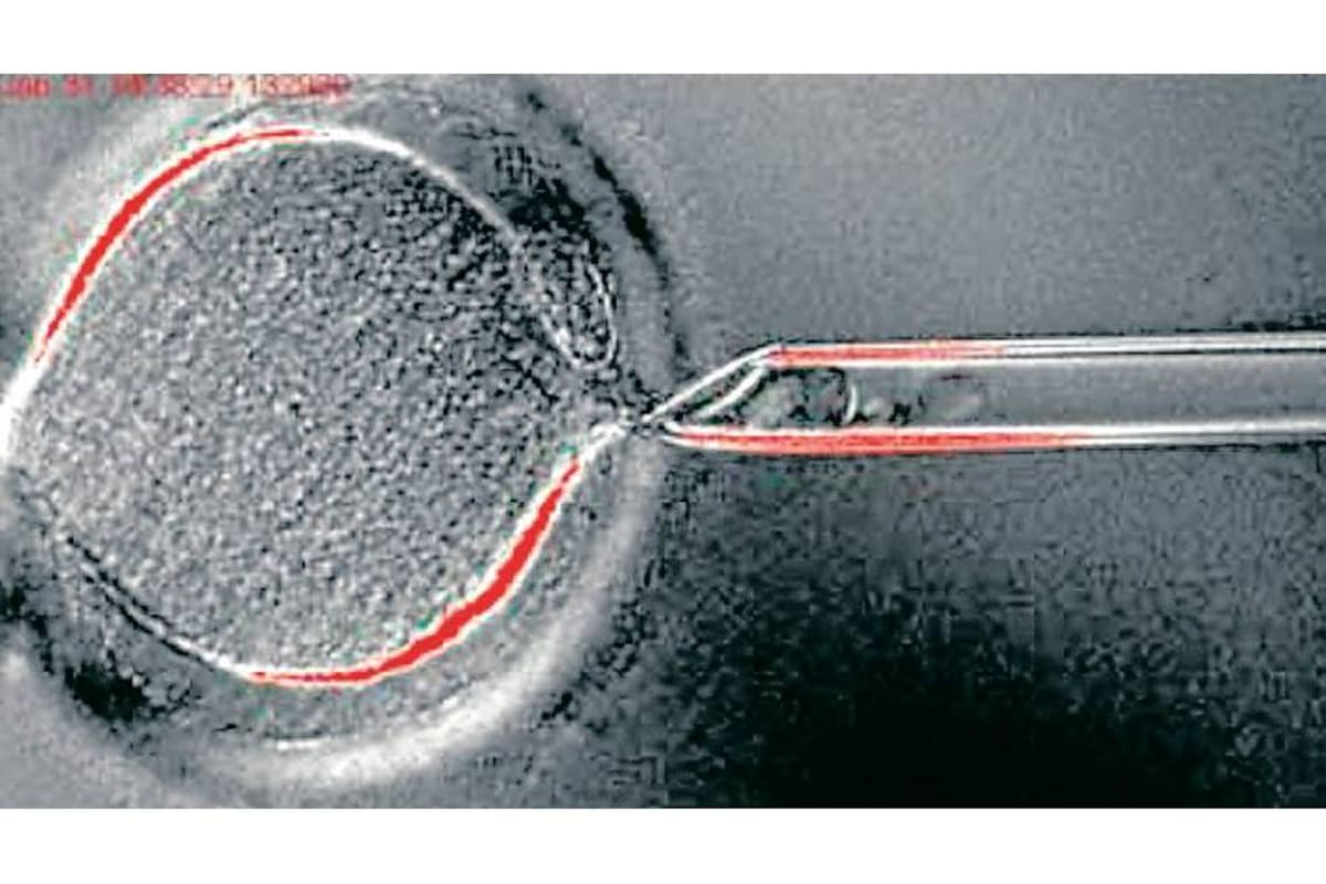 Aunque esta técnica puede utilizarse para clonar células madre (clonación terapéutica), el mismo método no permitiría a priori clonar con éxito humanos (clonación reproductiva). (Foto: Tomada de Internet / VANGUARDIA LIBERAL)