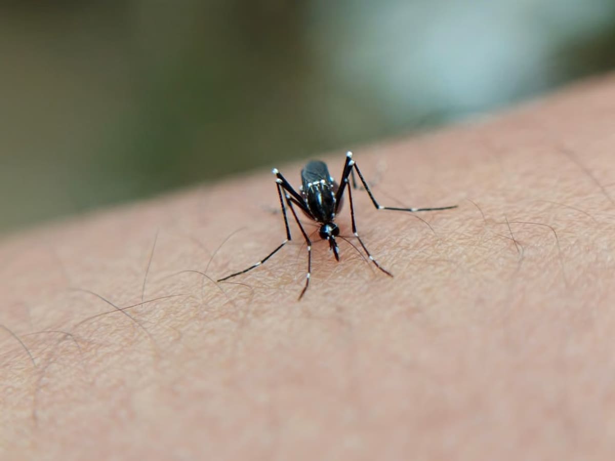 El dengue, producido por un mosquito, suele comenzar con fiebre y puede estar acompañado de dolor de cabeza, dolor detrás de los ojos, dolores musculares, articulares u óseos, náuseas, vómitos y sarpullido.