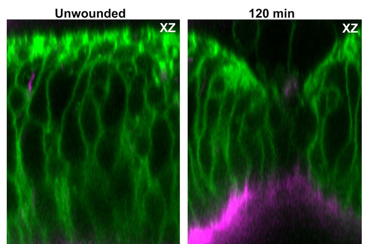 A la izquierda, imagen de microscopía de tejido epitelial sin herida. A la derecha, con herida realizada 120 minutos después con un láser. Crédito: Laboratorio de Yanlan Mao, imagen facilitada por el investigador Pablo Vicente-Munuera.