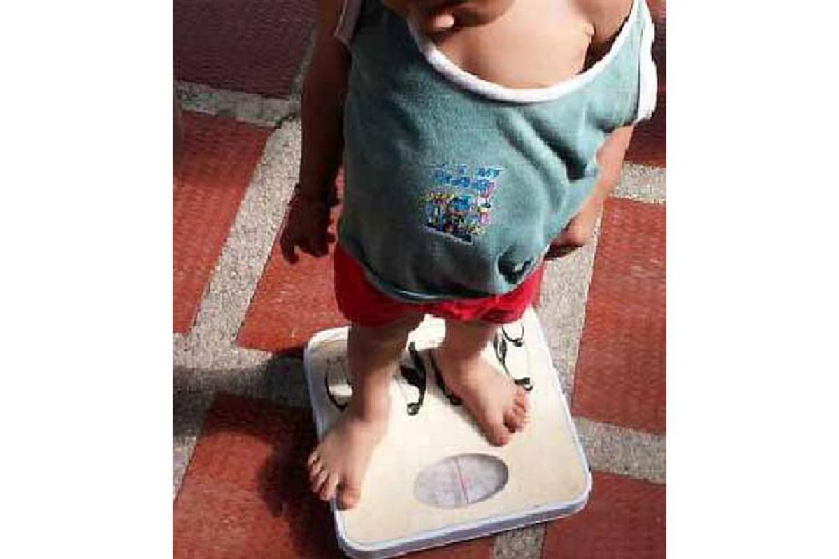 Para poder establecer cuándo un niño se encuentra desnutrido, es necesario saber cuánto pesa y cuánto mide. (Foto: / VANGUARDIA LIBERAL)