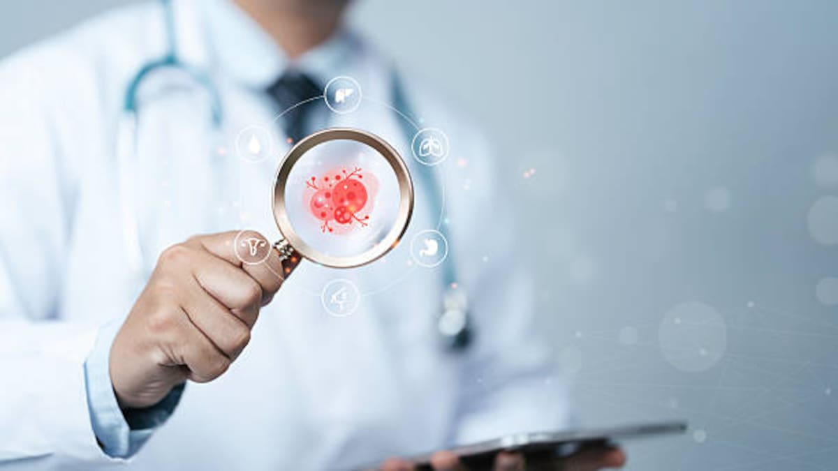 Detección antes de los síntomas: el cáncer colorrectal puede desarrollarse sin dolor ni señales evidentes durante sus primeras etapas.