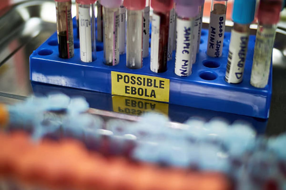 Aunque las cifras oficiales reportan poco más de 100 contagios, la OMS estima que hay más de 900 casos sospechosos y 220 muertes por el brote de ébola en África Central.