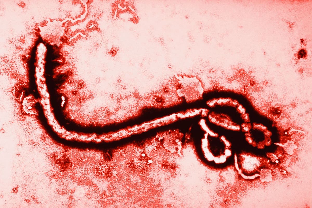 La OMS alerta por la "amplitud y rapidez" del brote de ébola en el Congo: 131 muertos y 513 casos sospechosos. No hay vacuna ni tratamiento para la cepa Bundibugyo. El virus ya cruzó a Uganda y EE. UU. restringe visados.