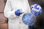 Brote de ébola se expande: virus llega a Uganda y EE.UU. toma medidas de control