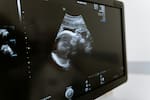 La Superintendencia de Salud reglamenta acceso libre al aborto hasta la semana 24