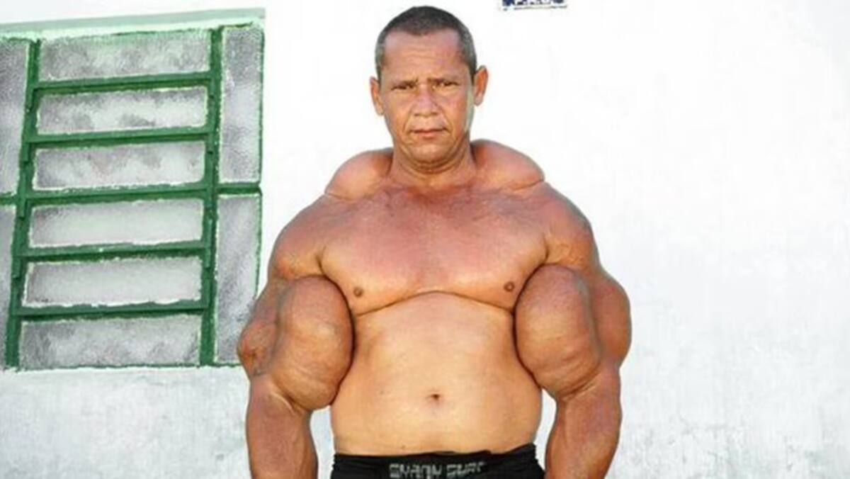 El oscuro precio del físico extremo: falleció el 'Popeye brasileño'.