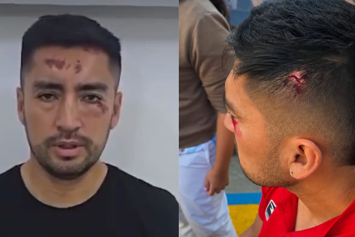 Exjugador del Atlético Bucaramanga sobrevivió al terremoto en Cali: quedó herido tras colapso de hotel.