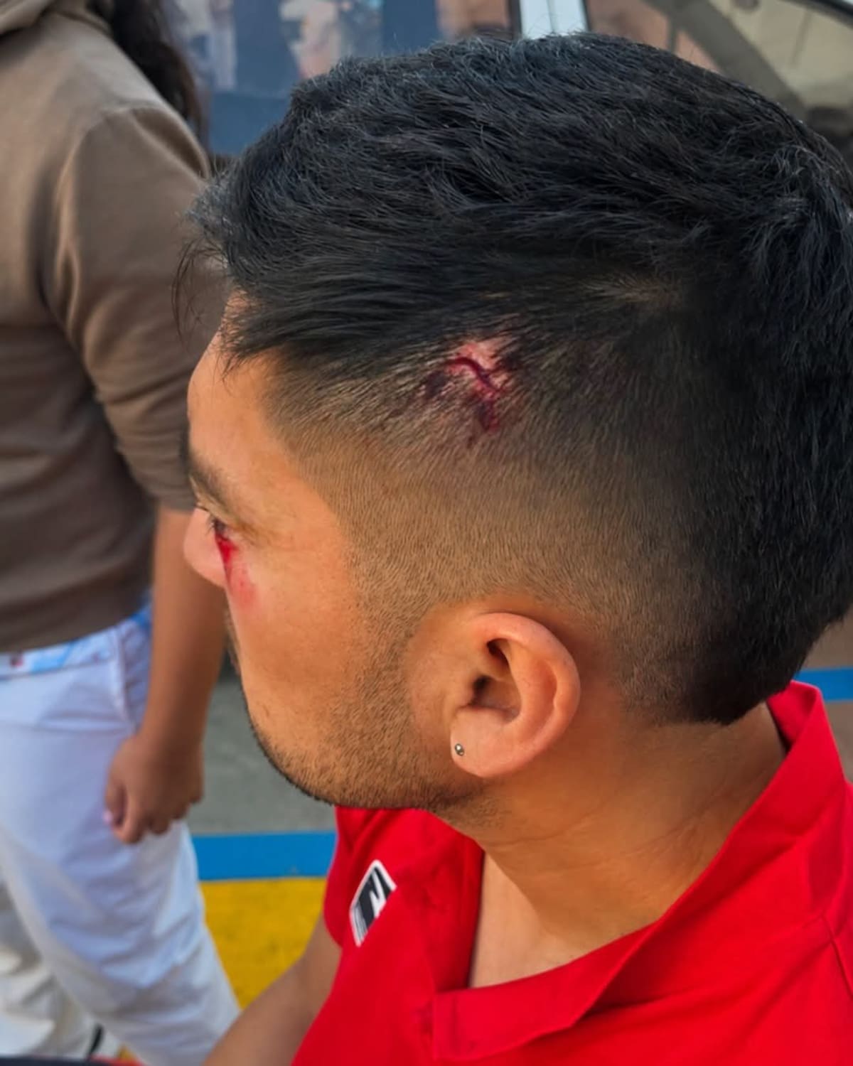 Exjugador del Atlético Bucaramanga sobrevivió al terremoto en Cali: quedó herido tras colapso de hotel.