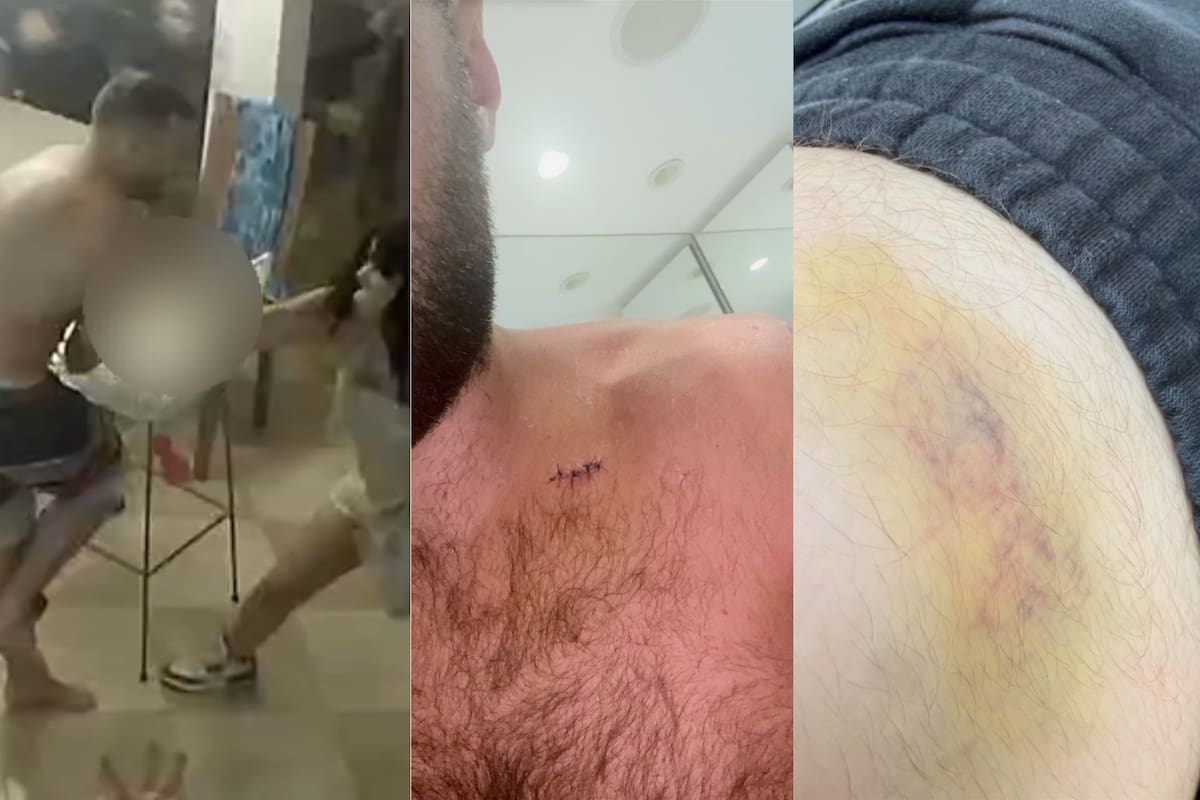 Extranjero denunció que fue apuñalado tras una cita de Tinder en Colombia. Foto: capturas de video