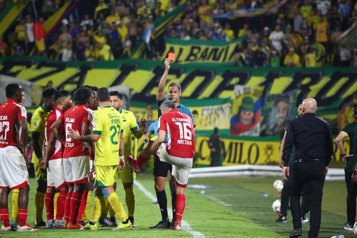 El volante sufrió un corte profundo en la pierna y afectación en el músculo tibial, según confirmó tras el partido. /FOTO: Jaime Moreno