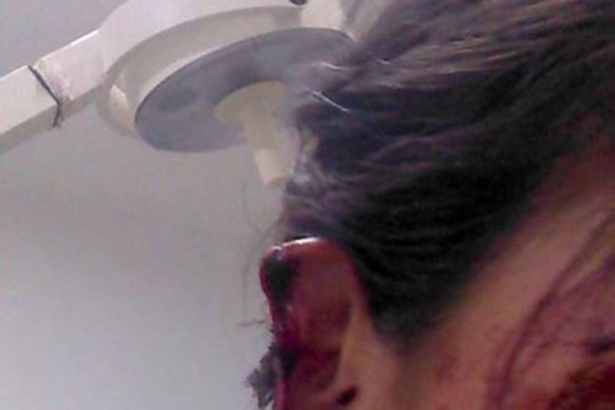 Denuncian agresión contra mujer en Santander (Foto: Suministrada/VANGUARDIA LIBERAL)